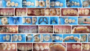 curso de fotografia dental