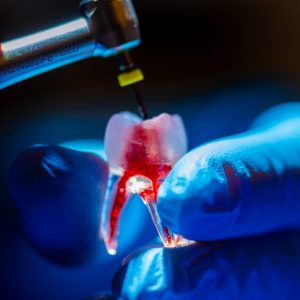 cursos de endodoncia